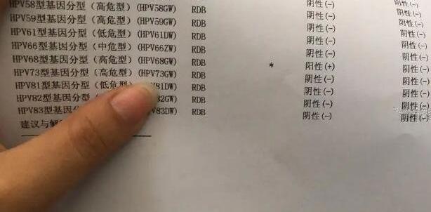 女性做HPV检查多少钱可以医保吗，200至400元左右不能报销